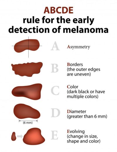 Xmelanoma Skin Cancer Chroma Dermatology