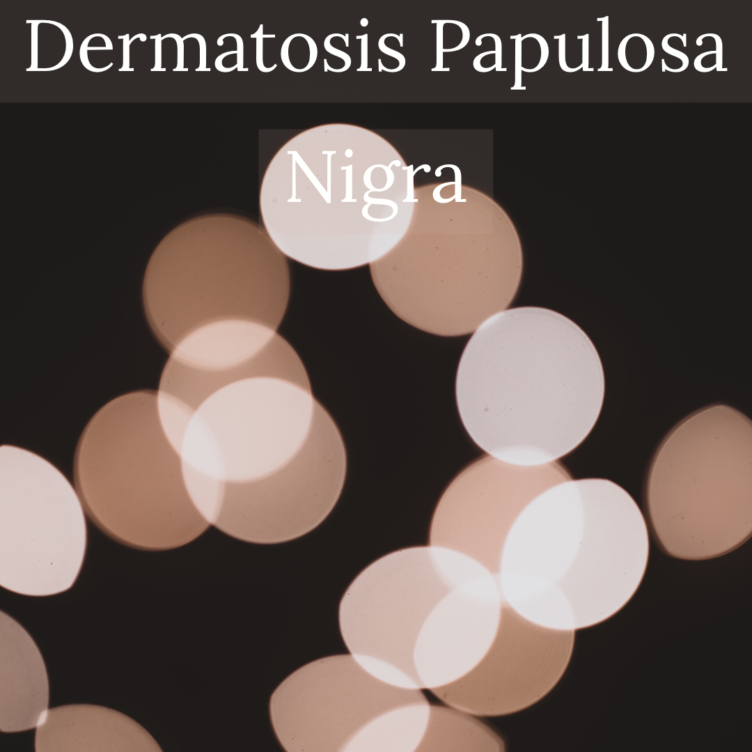 Dermatosis-Papulosa-Nigra-Chromaderm