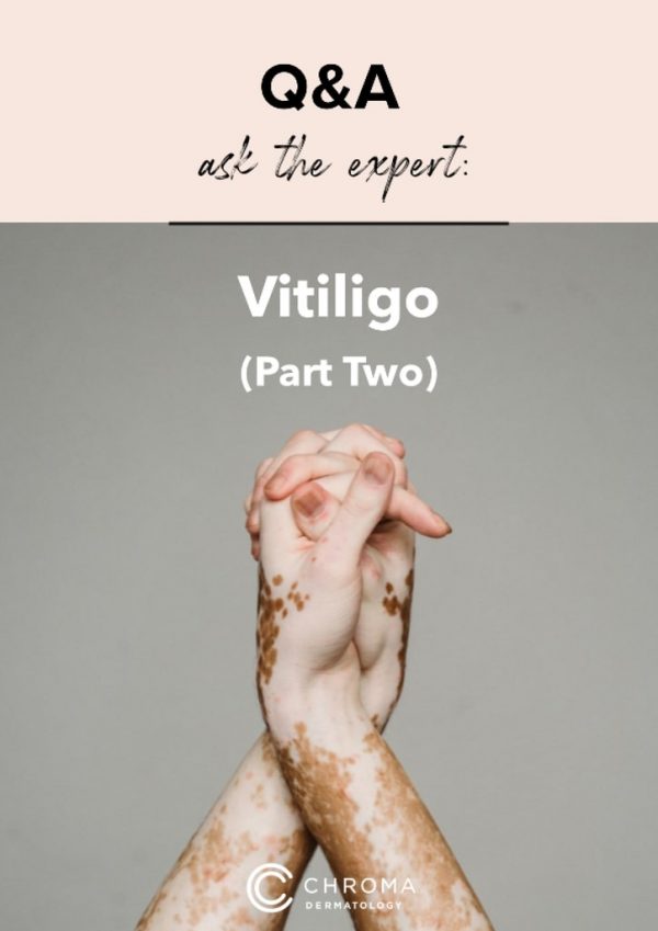recent research in vitiligo
